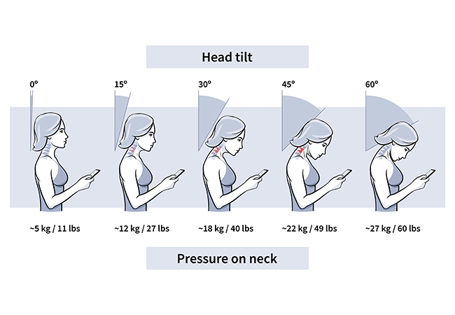 Posture Could Be the Culprit Behind Your Shoulder Pain